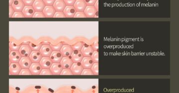 Vitamin C Hyaluronic Serum